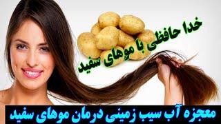 سیب زمینی_ درمان موهای سفید با آب سیب زمینی_ خواص سیب زمینی_ فواید سیب زمینی برای پوست