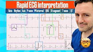 Rapid structured ECG interpretation A visual guide FOR REVISION #electrocardiogram