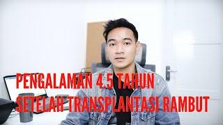 4.5 TAHUN SETELAH TRANSPLANTASI RAMBUT PELAJARAN PENTING