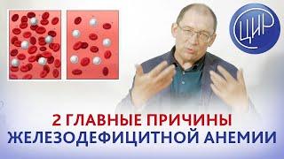 Дефицит железа. 2 главных причины низкого железа в крови кровопотери и проблемы с ЖКТ. Целиакия.