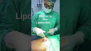 Why liposuction is not a good choice for lipoma removal ?