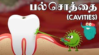 பல் சொத்தை  What Causes Cavities  Dr. Binocs Tamil  Best Learning Videos For Kids