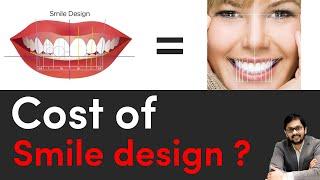 Cost of smile design ?  Dr Ankit khasgiwala  Seraphic dental clinic Indore