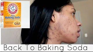 Back To Baking Soda 2 WEEKS Challenge - BEFORE