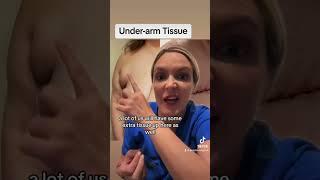 Under Arm Tissue in FTM Top Surgery #genderaffirmingcare #plasticsurgeon #ftmtransgender