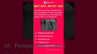 NEET MDS  INI-CET MDS  PSC  BDS - Most Important Questions  #neetmds2025 #mdsprep