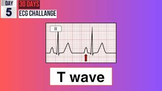 Day 5 Demystifying T Waves  30-day ECG Challenge