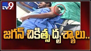 YS Jagan visuals in Citi Neuro hospital - TV9 Exclusive