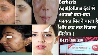 Berberis Aquifolium Gel For Acne Pimples blotches & Scars Skin Review  Dark Spot removel Best Gel