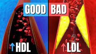 Why You Might Have A HIGH Cholesterol - Doctor Explains