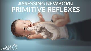 Assessing Newborn Primitive Reflexes by N. Gold  OPENPediatrics