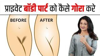 प्राइवेट बॉडी पार्ट को कैसे गोरा करे  Private part whitening cream 