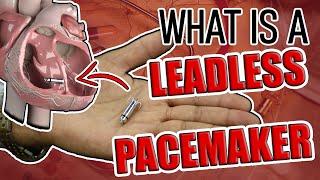 What is a Leadless Pacemaker?