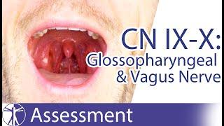 Cranial Nerve 9 & 10  Glossopharyngeal & Vagus Nerve Assessment for Physiotherapists