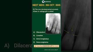 NEET MDS  INI-CET MDS  PSC  BDS - Most Important Questions  #neetmds2025 #mdsprep