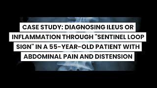 CASE STUDY DIAGNOSING ILEUS OR INFLAMMATION THROUGH SENTINEL LOOP SIGN