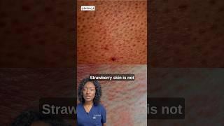 Hidden Causes Of Strawberry Skin + Products  Causes Of Red Dots On Legs