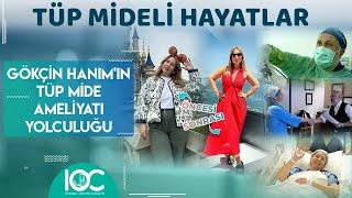 Gökçin Hanımın Tüp Mide Ameliyatı Yolculuğu  İstanbul Obezite Cerrahisi