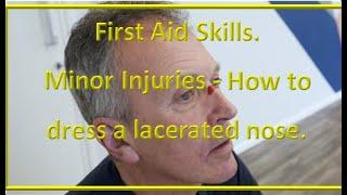 First Aid Skills. How to dress nose wounds e.g. a laceration to the bridge of the nose.