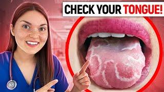 What your TONGUE says about your HEALTH Doctor Explains