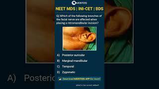 NEET MDS  INI-CET MDS  PSC  BDS - Most Important Questions  #neetmds2025 #mdsprep