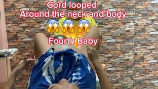 Natural Birth  Cord Looped around neck and body   Fourth Baby 