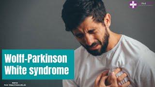 Wolff Parkinson White WPW syndrome  Cardiac Rhythm