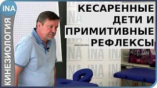 Кесаренные дети и примитивные рефлексы. Обучение прикладной кинезиологиии.