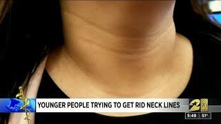 How to get rid of tech neck — creases in your neck that arent caused by age