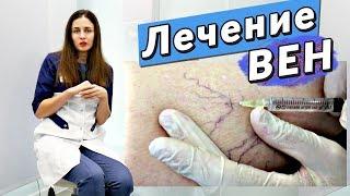 Как быстро удалять сосудистые звездочки? опыт врача