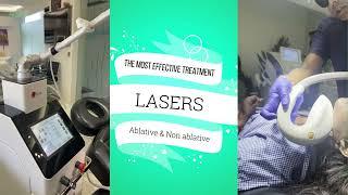 Laser treatment  burn scar and keloids.