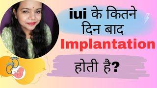 iui के कितने दिन बाद implantation होती है। iui ke kitne din baad implantation hoti hai.#iui