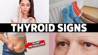 HYPOTHYROIDISM Don’t Ignore These 7 Early Warning Signs