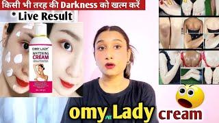 omy lady whitening cream which cream is best for Whitening?meesho omy lady cream@Meesho 2023