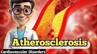 Atherosclerosis  Dow University  AHN  NTS