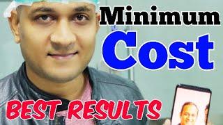 Hair Transplant Cost ??  Regrow Clinic Haridwar  Hair Transplant In India  Call 9528168089