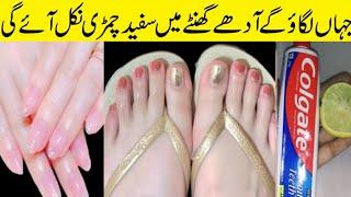 Hands Feet Whitening DIY  Instant Hands Feet Whitening Home Remedies  Hands Whitening Formula