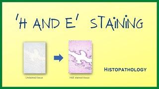H & E Staining  Hematoxylin and Eosin stain  Histopathology  Hindi