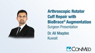 Dr. Ali Maqdes - PRESENTATION 2023 Arthroscopic Rotator Cuff Repair with BioBrace® Augmentation