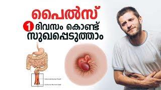 പൈൽസ് ഒരു ദിവസം കൊണ്ട് സുഖപ്പെടുത്താം  Piles Malayalam Health Tips