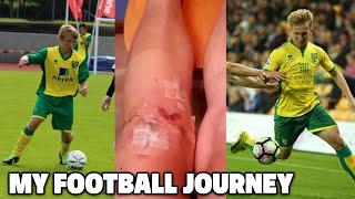 Becoming A Professional Footballer - ACL Surgery Being Released & Academy Truth.. My Pro Journey