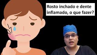 Rosto inchado ? Tem algum risco? O que fazer? Dra Bianca Rosa  Clínica Bianca Rosa