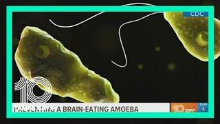 How to avoid brain-eating amoeba while swimming this summer