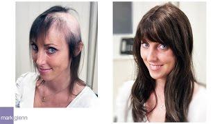 Female Hair Loss Solution - Mark Glenn Hair Enhancement London