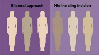 A new surgical approach for iatrogenic urinary obstruction after midurethral sling