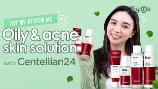 Try Me Review Me One Stop Solution for Oily & Acne Skin
