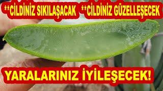 TÜM YARALARINIZ İYİLEŞECEK CİLDİNİZ SIKILAŞACAK. DOĞAL BİR KOLOJEN AJANI Aloe Vera Barbadensis