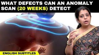 What defects can an anomaly scan 20weeks detect  கருவின் குறைபாடுகளை அறிய உதவும் அனாமலி ஸ்கேன்