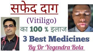 Vitiligo { Safed Daag } ka Best treatment  Tacrolimus ointment  Femcort cream  Pigmento ointment