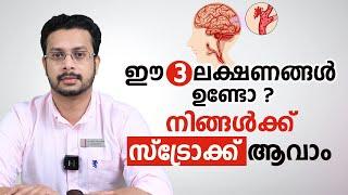 സ്ട്രോക്ക് ഈ 3 ലക്ഷണങ്ങൾ ഒരിക്കലും അവഗണിക്കരുത്  Stroke Malayalam  Rajagiri Hospital